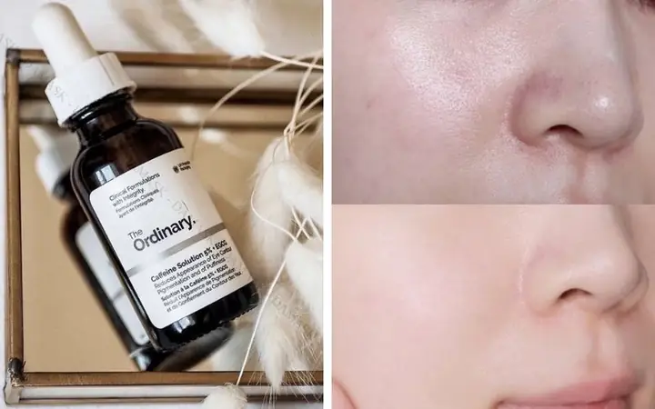 Top Serum Dưỡng Trắng Da Hiệu Quả Nhất Hiện Nay: Lựa Chọn Tinh Chất Sáng Da Toàn Diện