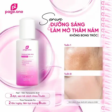 Top Serum Trị Tàn Nhang Hiệu Quả: Bí Quyết Lấy Lại Làn Da Sáng Mịn