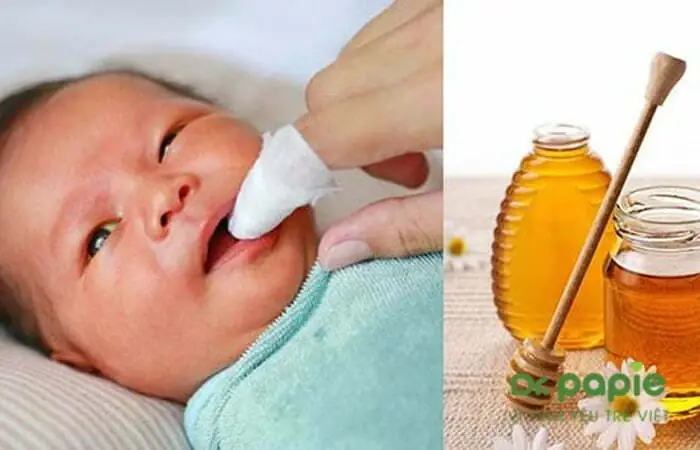 Trẻ Sơ Sinh Uống Mật Ong Được Không? Rủi Ro Và Thời Điểm An Toàn