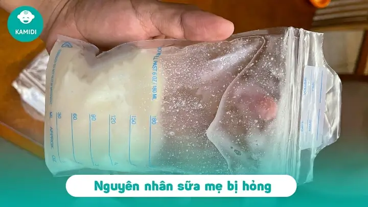 Cách Nhận Biết Sữa Mẹ Trữ Đông Bị Hỏng: Dấu Hiệu, Nguyên Nhân Và Cách Xử Lý An Toàn Cách Nhận Biết Sữa Mẹ Trữ Đông Bị Hỏng: Dấu Hiệu, Nguyên Nhân Và Cách Xử Lý An Toàn
