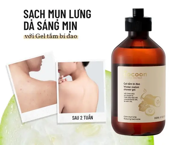 Top 7+ Sữa Tắm Trị Mụn Lưng Tốt Nhất Hiện Nay: Hướng Dẫn Chọn Lựa Hiệu Quả