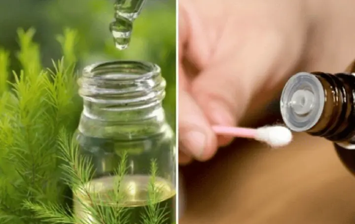 Tinh Dầu Tràm Trà: Trị Mụn Hiệu Quả, An Toàn Cho Mọi Làn Da