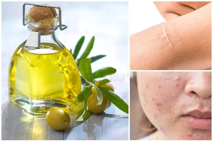 Dầu Mù U: Cảnh Báo Tác Dụng Phụ & Lưu Ý An Toàn Khi Sử Dụng Cho Da