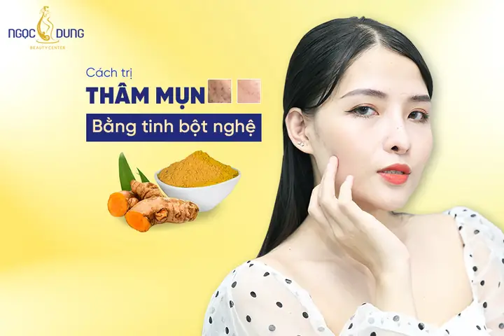 Tinh Bột Nghệ Có Trị Thâm Không? Bí Quyết Mờ Thâm Hiệu Quả & An Toàn Tại Nhà