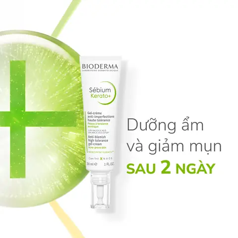 Top Kem Dưỡng Ẩm Cho Da Mụn Tốt Nhất 2026: Lựa Chọn Chuẩn Cho Làn Da Khỏe Mạnh