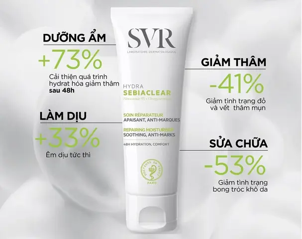 Top Kem Dưỡng Ẩm Cho Da Mụn Tốt Nhất 2026: Lựa Chọn Chuẩn Cho Làn Da Khỏe Mạnh
