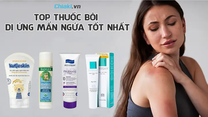 Trẻ Bị Dị Ứng Bôi Thuốc Gì? Hướng Dẫn Chọn Thuốc An Toàn & Hiệu Quả