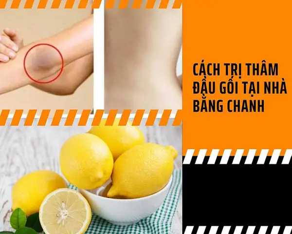 9+ Cách Trị Thâm Đầu Gối Nhanh Nhất Tại Nhà: Bí Quyết Da Mịn Màng, Sáng Màu