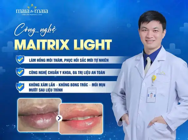 Trị Thâm Môi Lip Light Có Tốt Không? Đánh Giá Chi Tiết Và Giải Pháp Hiệu Quả