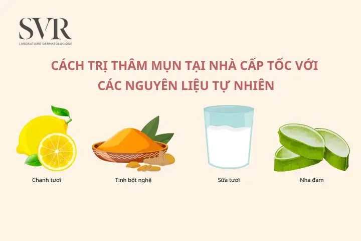 Trị Thâm Sau Mụn Tại Nhà: Bí Quyết Hiệu Quả Từ Thiên Nhiên & Khoa Học