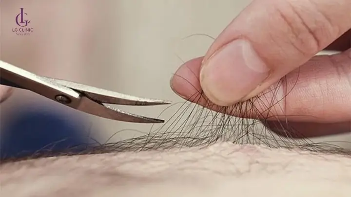 Trước Khi Sinh Có Nên Cạo Lông Vùng Kín Không? Lời Khuyên Từ Chuyên Gia