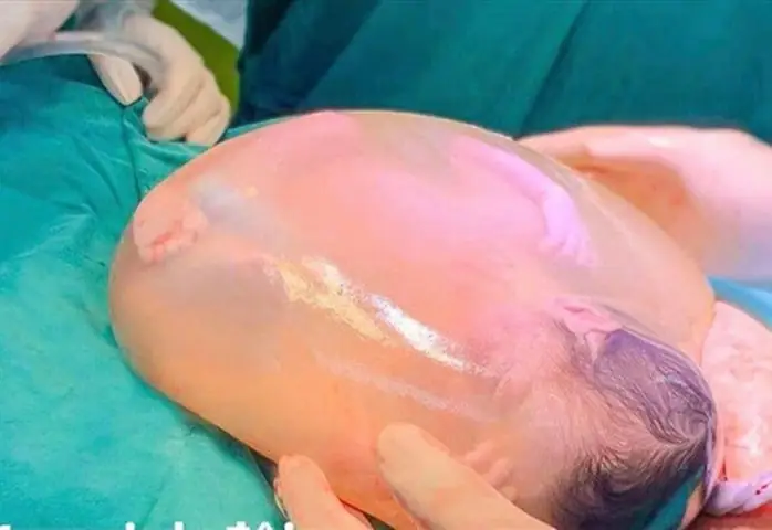 Vận Mệnh Người Sinh Bọc Điều: Giải Mã May Mắn Và Ý Nghĩa Khoa Học Vận Mệnh Người Sinh Bọc Điều: Giải Mã May Mắn Và Ý Nghĩa Khoa Học